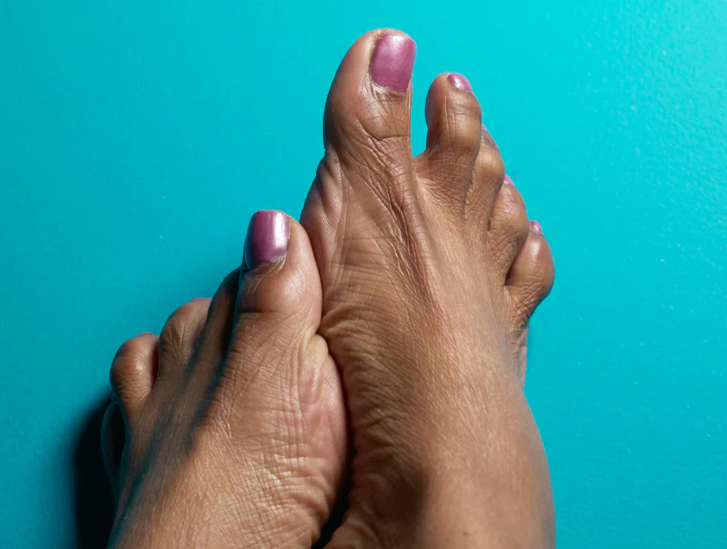 Diabetes Foot Care: Treatment &amp; Healthy Foot Care Tips